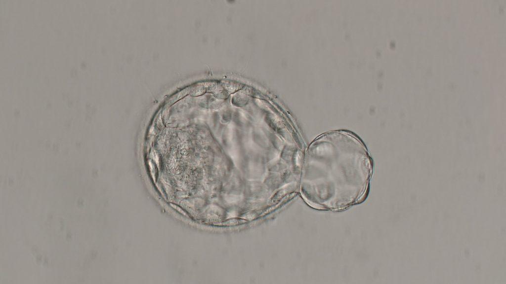embryon à J5