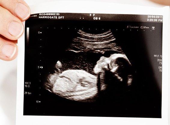 bébé
